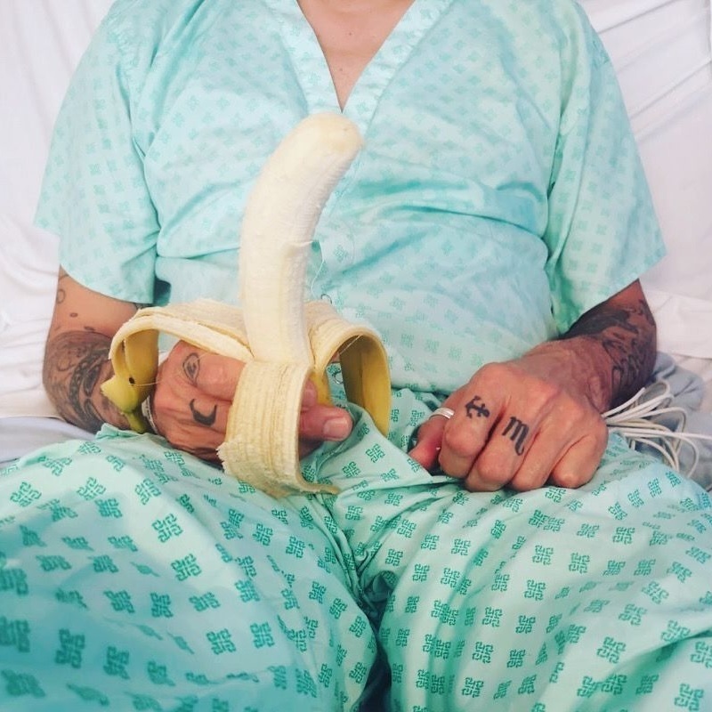 Markus Birdman in hospital pajamas, sitting on a hospital bed, holding a half-peeled banana in his hands.