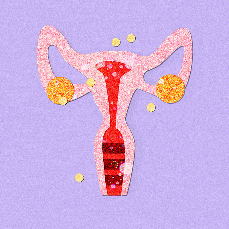 Endo Days - Against a lilac background is a 2D representation of a uterus in mottled pale pink with a red vaginal canal and orange ovaries. Overlayed are some transparent white circles, and 6 yellow circles that are place in scattered positions outside the uterus to represent spots of endometriosis. The image is stylised in the style of papercut crafts with a mottled texture across the entire image.
