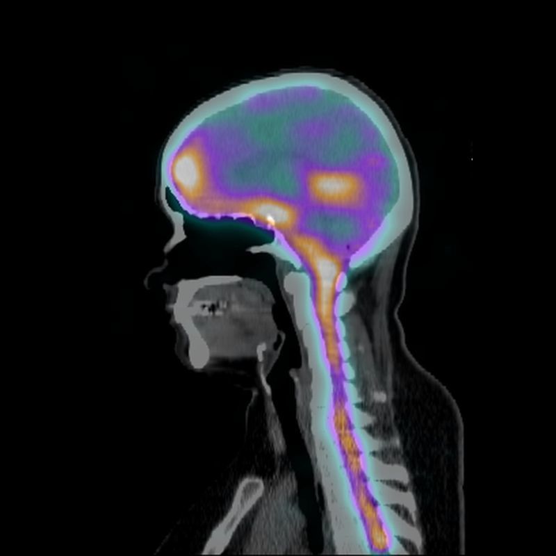 A side view of a medical scan of the head and shoulders of a person. The bones and flesh are shades of grey against the black background. The brain and spinal cord are a rainbow of pretty colours.